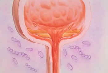 ��·��Ⱦ��֢״